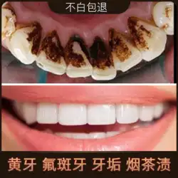 歯のクリーニングアーティファクトツール歯石除去溶解歯石スケーラー家庭用クリーニング歯石プラークを除去
